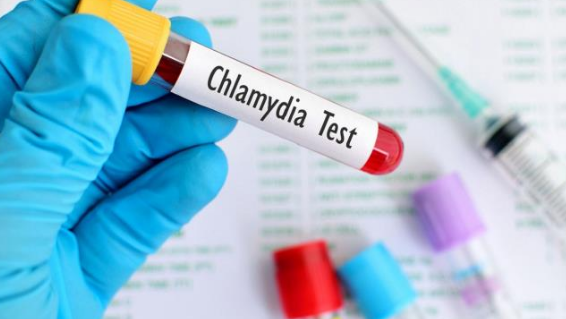 xét nghiệm chlamydia